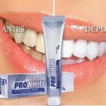 Crema Prohwite blanqueadora dental HND